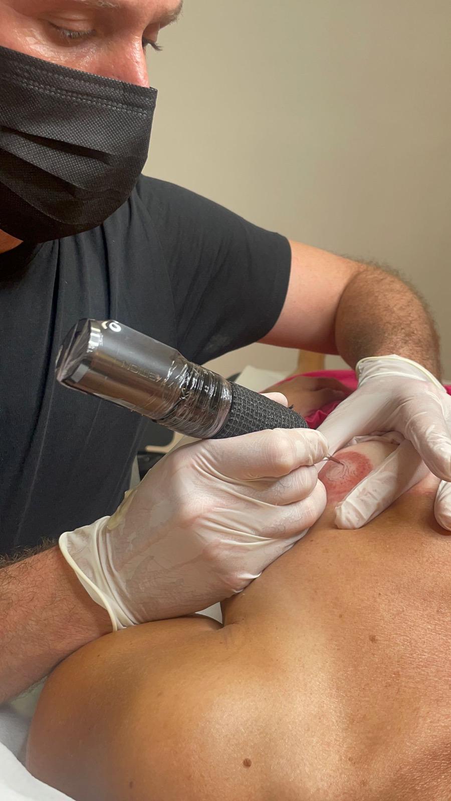 tatuaje oncológico Tarragona